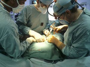 Kidney Transplant